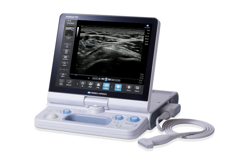 diagnostic ultrasound machine - Imag Pros LLC