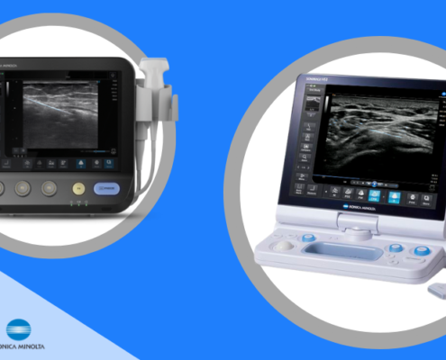 ultrasound machines