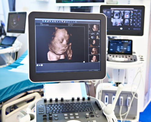 Ultrasound Devices