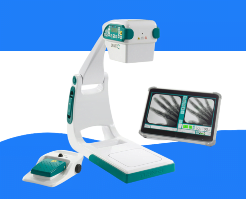 the mini c-arm