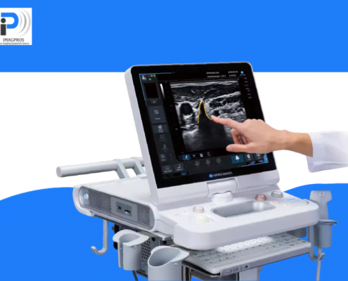 diagnostic ultrasound machines